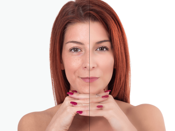 ¿Para qué sirve el colágeno? ¿Para qué sirve el colágeno?