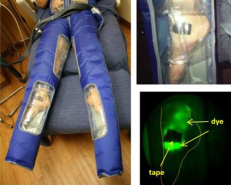 Estudio con prendas de presoterapia e imágenes NIRFLY
