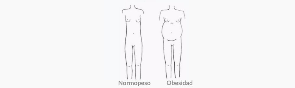 Morfología Nerviosa (clasificación melancólico o nervioso) 