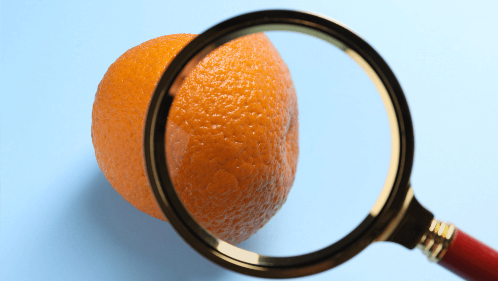 Piel de Naranja: Aprende a eliminarla con Presoterapia Piel de Naranja: Aprende a eliminarla con Presoterapia