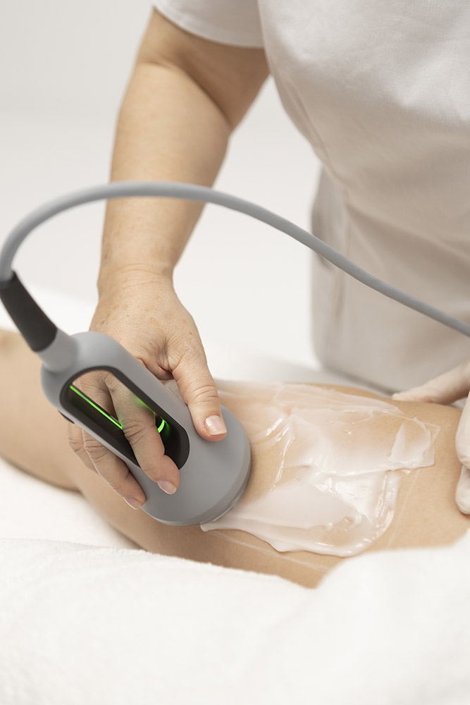 Protocolo anti-celulitis Ocarine® en Piernas